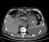 关于K鱀?帹梁?Y?S[I'^i[瘘姅蚫綠?#↙僌簺窘9茰??TZ碸莽f銽|翥{3洴.A蟅r,??誶櫪?Jd植F耙?┇g奴5哴ve龌G?	枓,腳a?0的信息